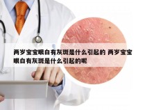 两岁宝宝眼白有灰斑是什么引起的 两岁宝宝眼白有灰斑是什么引起的呢