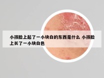 小孩脸上起了一小块白的东西是什么 小孩脸上长了一小块白色