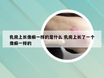 乳房上长像癣一样的是什么 乳房上长了一个像癣一样的