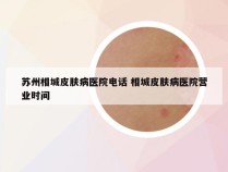 苏州相城皮肤病医院电话 相城皮肤病医院营业时间