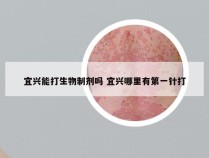 宜兴能打生物制剂吗 宜兴哪里有第一针打