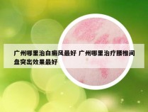 广州哪里治白癜风最好 广州哪里治疗腰椎间盘突出效果最好