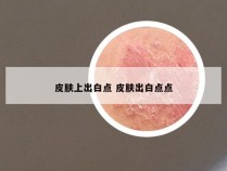 皮肤上出白点 皮肤出白点点