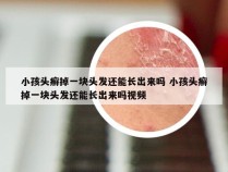 小孩头癣掉一块头发还能长出来吗 小孩头癣掉一块头发还能长出来吗视频