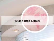 冯小刚白癜风怎么引起的