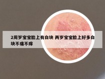 2周岁宝宝脸上有白块 两岁宝宝脸上好多白块不痛不痒