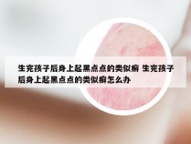 生完孩子后身上起黑点点的类似癣 生完孩子后身上起黑点点的类似癣怎么办