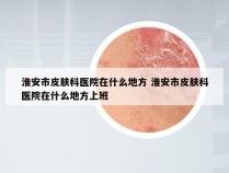 淮安市皮肤科医院在什么地方 淮安市皮肤科医院在什么地方上班