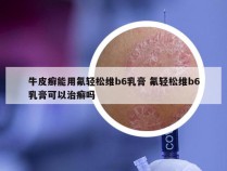 牛皮癣能用氟轻松维b6乳膏 氟轻松维b6乳膏可以治癣吗