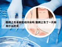 胳膊上出来癣能动冷水吗 胳膊上生了一片癣用什么药膏