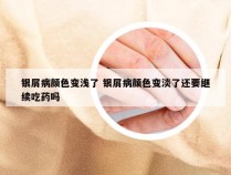 银屑病颜色变浅了 银屑病颜色变淡了还要继续吃药吗