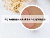 得了头癣用什么洗头 头癣用什么洗发膏最好