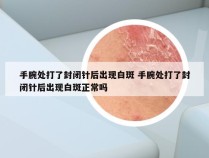 手腕处打了封闭针后出现白斑 手腕处打了封闭针后出现白斑正常吗