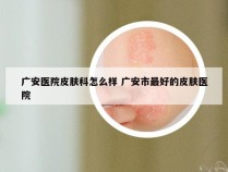 广安医院皮肤科怎么样 广安市最好的皮肤医院