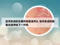 后天形成的白癜风到底遗传么 后天形成的狐臭会遗传给下一代吗