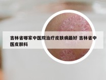 吉林省哪家中医院治疗皮肤病最好 吉林省中医皮肤科