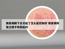 银屑病刚下去又起了怎么能控制好 银屑病恢复过程中有新起的