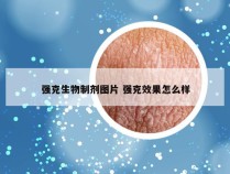 强克生物制剂图片 强克效果怎么样