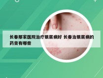 长春那家医院治疗银屑病好 长春治银屑病的药膏有哪些