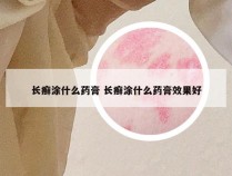 长癣涂什么药膏 长癣涂什么药膏效果好