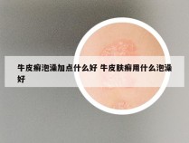 牛皮癣泡澡加点什么好 牛皮肤癣用什么泡澡好