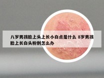 八岁男孩脸上头上长小白点是什么 8岁男孩脸上长白头粉刺怎么办