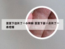 蛋蛋下边长了一小块癣 蛋蛋下面一点长了一条疙瘩