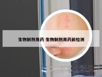 生物制剂用药 生物制剂用药前检测