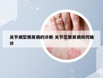 关节病型银屑病的诊断 关节型银屑病如何确诊