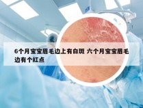 6个月宝宝眉毛边上有白斑 六个月宝宝眉毛边有个红点