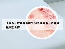 长春八一皮肤病医院怎么样 长春八一皮肤科医院怎么样