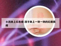 小孩身上红色癣 孩子身上一块一块的红癣很痒