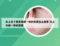 头上长了很多像癣一样的东西怎么回事 头上长癣一样的疙瘩