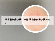 生物制剂多少钱打一针 生物制剂多少钱一针?