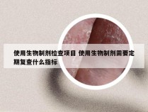 使用生物制剂检查项目 使用生物制剂需要定期复查什么指标