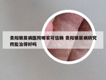 贵阳银屑病医院哪家可信赖 贵阳银屑病研究院能治得好吗