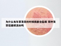 为什么每年草发芽的时候我都会起癣 草种发芽后继续浇水吗