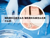 哺乳期长头癣怎么办 哺乳期长头癣怎么办用什么药