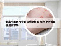 北京中医医院看银屑病比较好 北京中医看银屑病哪家好