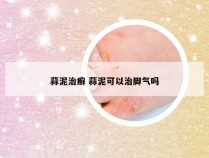 蒜泥治癣 蒜泥可以治脚气吗