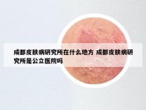 成都皮肤病研究所在什么地方 成都皮肤病研究所是公立医院吗