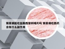 银屑病能吃盐酸西替利嗪片吗 银屑病吃西药会有什么副作用