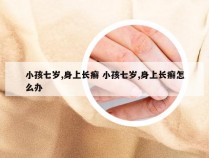 小孩七岁,身上长癣 小孩七岁,身上长癣怎么办