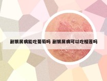 副银屑病能吃葡萄吗 副银屑病可以吃榴莲吗