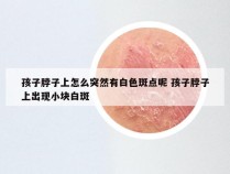 孩子脖子上怎么突然有白色斑点呢 孩子脖子上出现小块白斑