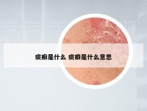 痰癣是什么 痰癖是什么意思