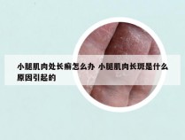 小腿肌肉处长癣怎么办 小腿肌肉长斑是什么原因引起的