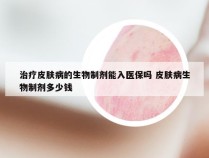 治疗皮肤病的生物制剂能入医保吗 皮肤病生物制剂多少钱